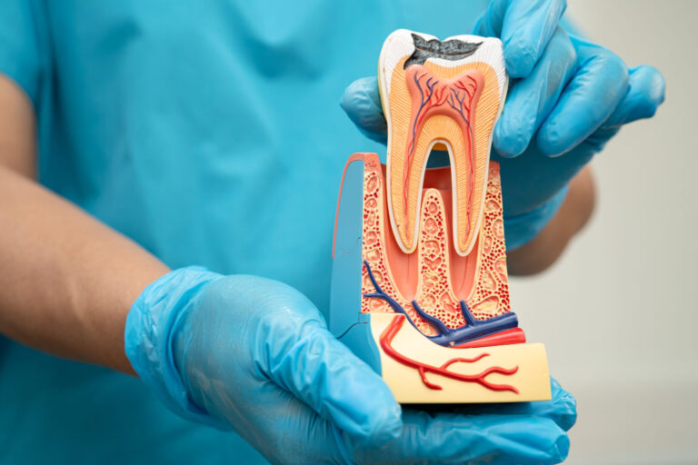 root canal therapy Toowong root canal therapy Toowong