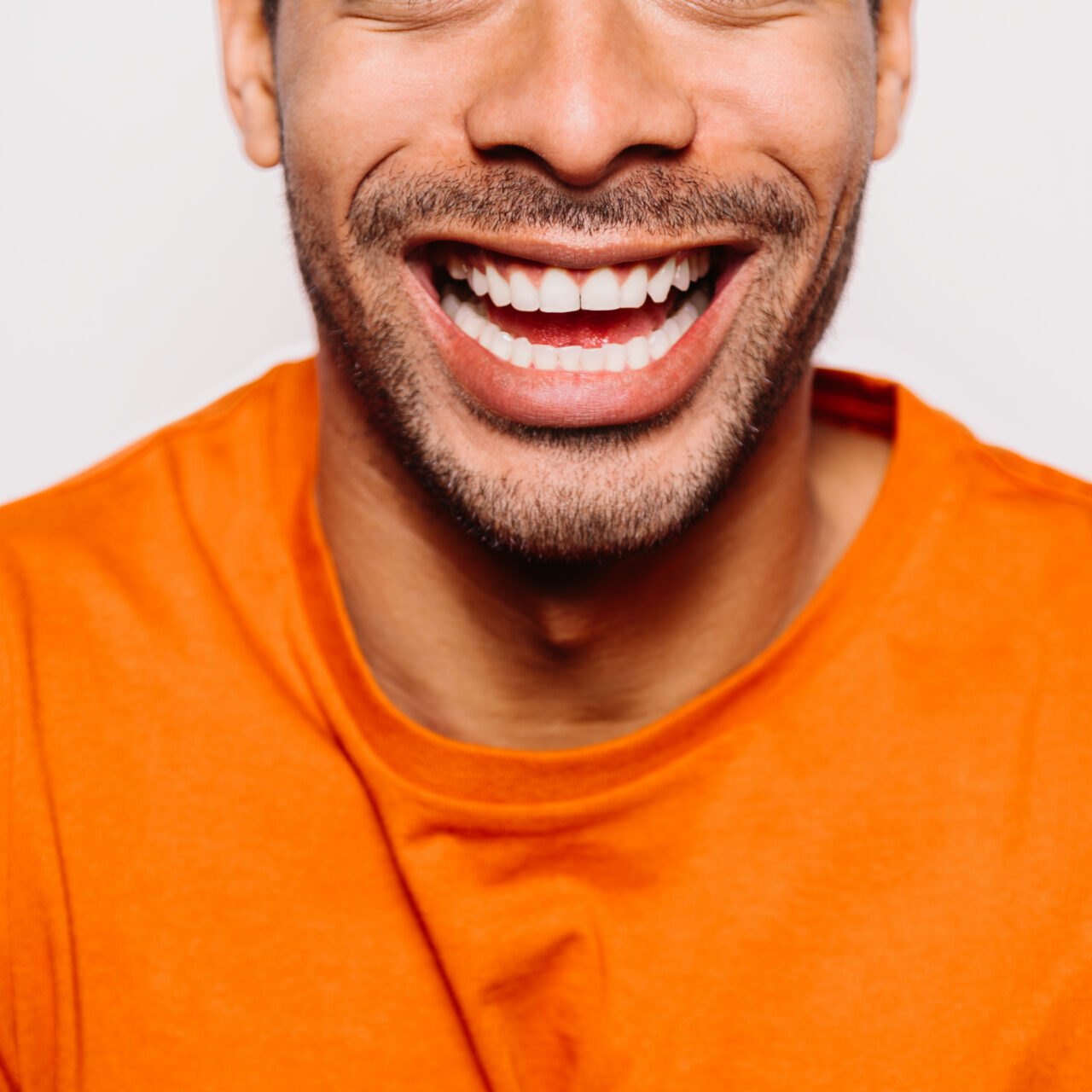 Teeth polishing and scaling Toowong Dentist