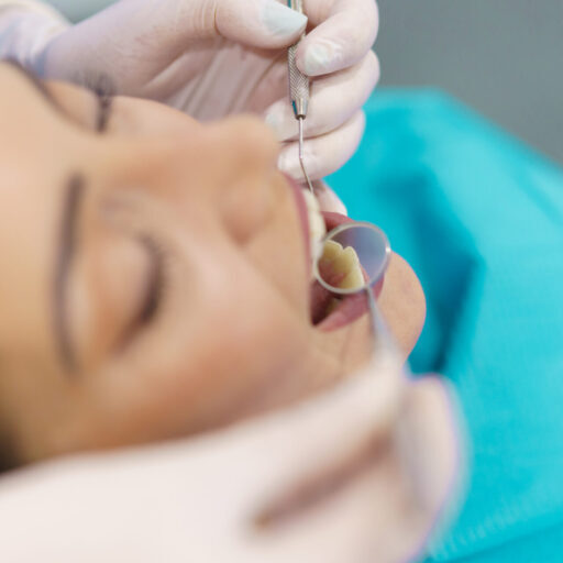 fillings Toowong