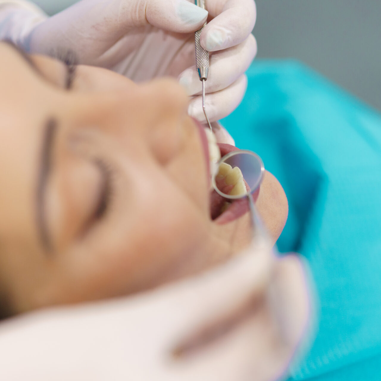 fillings Toowong
