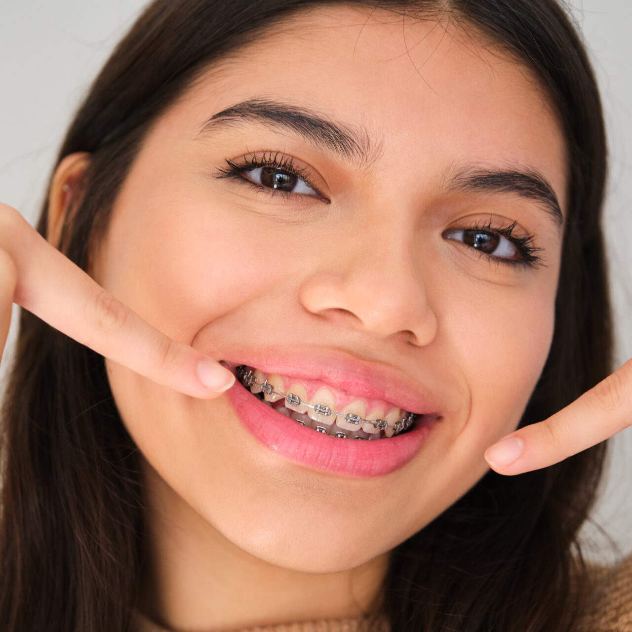 Orthodontics Toowong