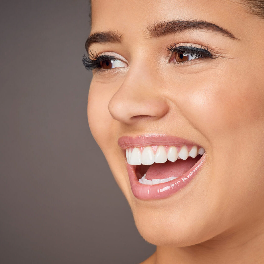 veneers Toowong Dental Group