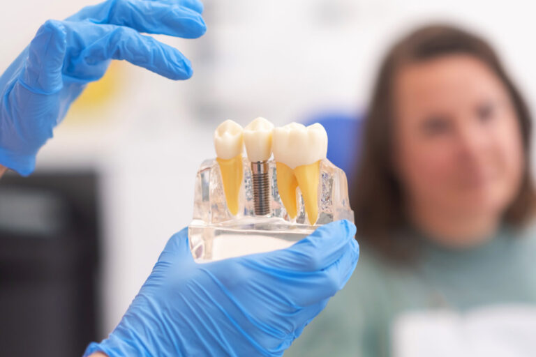 dental implants Toowong dental implants Toowong