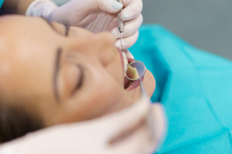 fillings Toowong fillings Toowong
