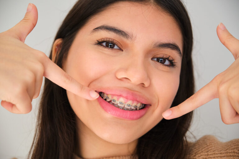 Orthodontics Toowong Orthodontics Toowong